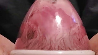 Klitoris besar, Klitoris, Pompa
